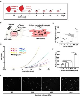 Inflammatory Cytokines Alter Mesenchymal Stem Cell Mechanosensing and Adhesion on Stiffened Infarct Heart Tissue After Myocardial Infarction